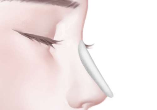 张辉隆鼻医生口碑如何?人气出圈、风格主打自然清新插图4 张辉隆鼻医生口碑如何?人气出圈、风格主打自然清新插图4