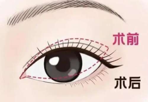 宁波整形外科医院是三甲医院吗?医院简介及特色项目介绍!插图2 宁波整形外科医院是三甲医院吗?医院简介及特色项目介绍!插图2