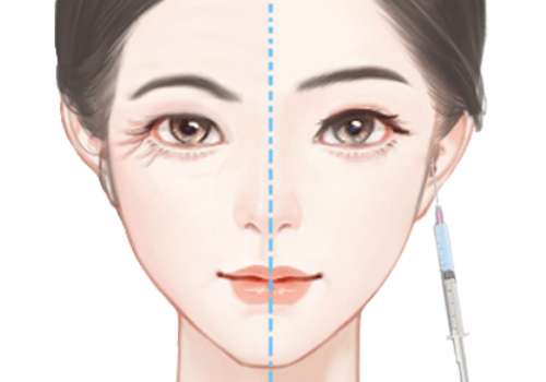 冯少清双眼皮价格贵吗?医生详情及2026最新价格更新插图3 冯少清双眼皮价格贵吗?医生详情及2026最新价格更新插图3
