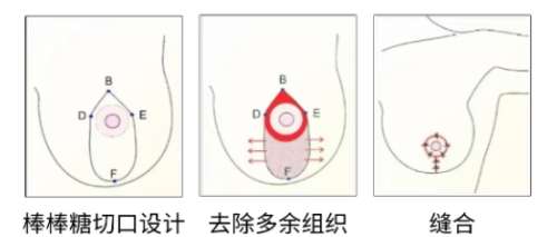 青岛脂肪隆胸医生名单!都是擅长做隆胸技术好实力强的医生!插图4 青岛脂肪隆胸医生名单!都是擅长做隆胸技术好实力强的医生!插图4