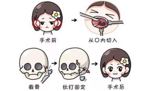 沈绍勇医生磨骨技术优势在线解析!医生各方面详细信息!插图1 沈绍勇医生磨骨技术优势在线解析!医生各方面详细信息!插图1