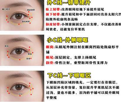 上海华美聂婕怎么样?医生口碑测评|擅长项目介绍插图4 上海华美聂婕怎么样?医生口碑测评|擅长项目介绍插图4