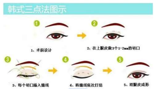 沈阳陆军总院谁做双眼皮好？院内医生名单附上！插图4