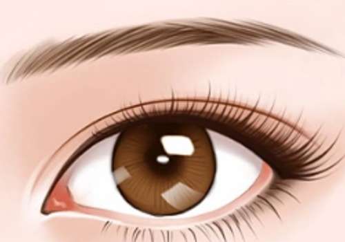 西安陈杰双眼皮修复怎么样？医生口碑技术价格全解析，附价格表插图2