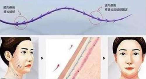 北京加减美黄寅守医生口碑怎么样啊?坐诊医院基本信息及面部提升案例分析插图3 北京加减美黄寅守医生口碑怎么样啊?坐诊医院基本信息及面部提升案例分析插图3