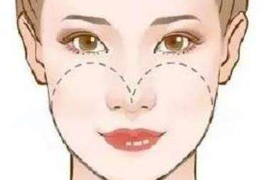何晋龙磨骨偏什么风格?坐诊医院是哪家?磨骨实例插图3 何晋龙磨骨偏什么风格?坐诊医院是哪家?磨骨实例插图3