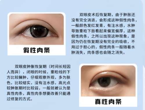 深圳双眼皮修复好的医生?医生简介|医院背景介绍插图4 深圳双眼皮修复好的医生?医生简介|医院背景介绍插图4