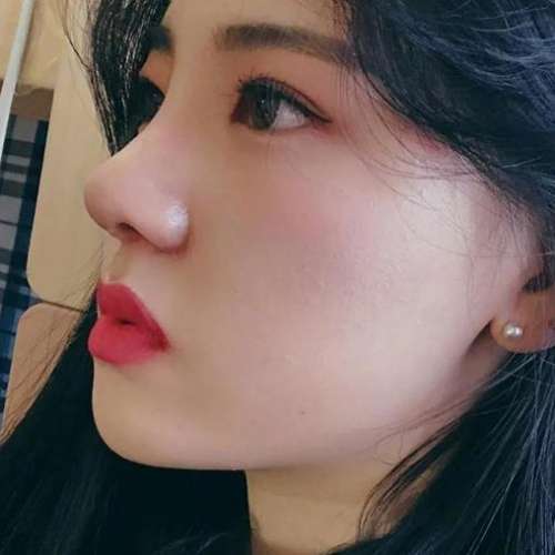 李劲良做鼻子对比案例分析插图4 李劲良做鼻子对比案例分析插图4