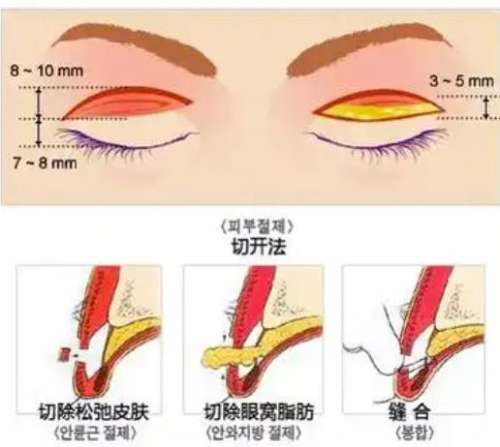 北京双眼皮修复专家王太玲简介!医美免费咨询,获取公立医院医生信息与价格!插图2 北京双眼皮修复专家王太玲简介!医美免费咨询,获取公立医院医生信息与价格!插图2