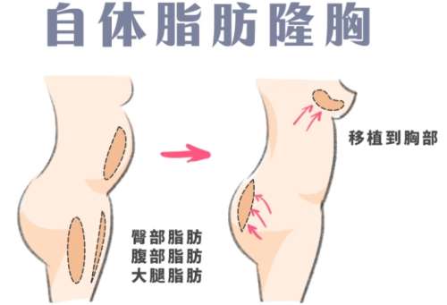 宁波脂肪填充医生排名公布！靠谱医院排名靠前|看详细介绍插图4