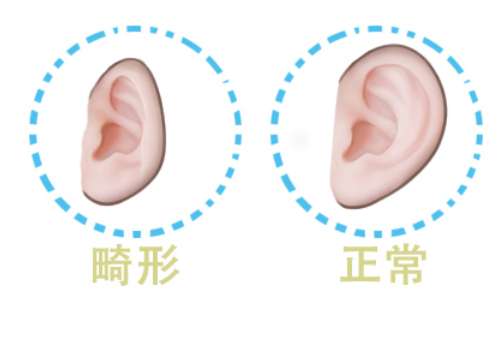 董立维医生口碑和评价|做手术怎么样？经验丰富、做的耳朵自然、对称插图3