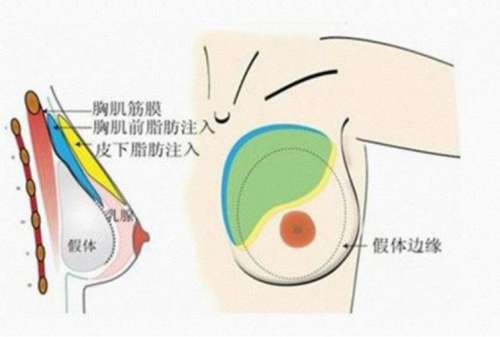 闫爱跃隆胸怎么样?就职于哪家医院?胸部整形项目流程分析插图4 闫爱跃隆胸怎么样?就职于哪家医院?胸部整形项目流程分析插图4