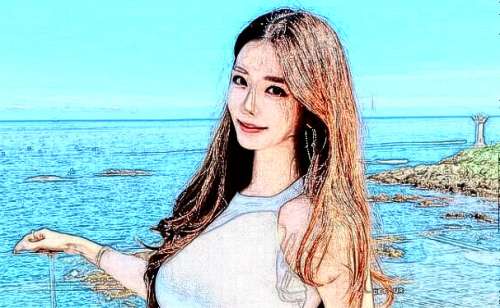 菏泽市立医院隆胸术后一年恢复案例分析插图1