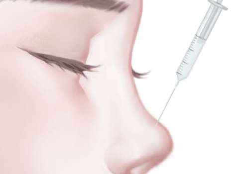 龙飞鼻整形怎么样?审美自然|手法精细|人气很高!插图4 龙飞鼻整形怎么样?审美自然|手法精细|人气很高!插图4
