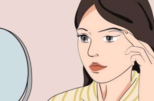 济南美莲美容整形医生怎么样？医生名单|真人双眼皮案例分析插图3