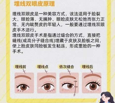 胡志奇医生手术费用分析2026年在线更新!一文看清医生实力!插图4 胡志奇医生手术费用分析2026年在线更新!一文看清医生实力!插图4