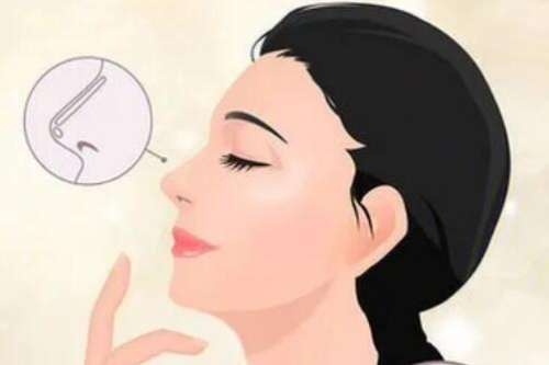 童列健做鼻子好吗?医生简介|技术特点剖析!插图2 童列健做鼻子好吗?医生简介|技术特点剖析!插图2