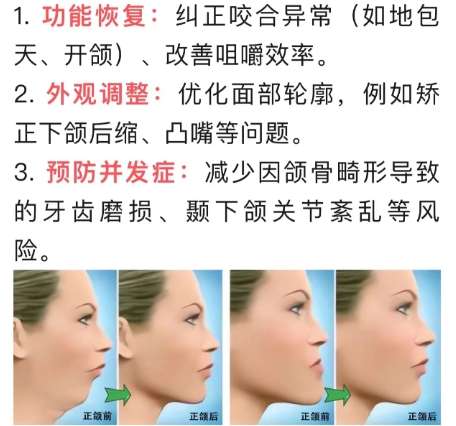 西安正颌手术好的医院医生有很多!一起来看看具体内容吧!插图4 西安正颌手术好的医院医生有很多!一起来看看具体内容吧!插图4