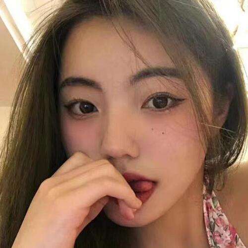 李圣利双眼皮案例分析插图2 李圣利双眼皮案例分析插图2