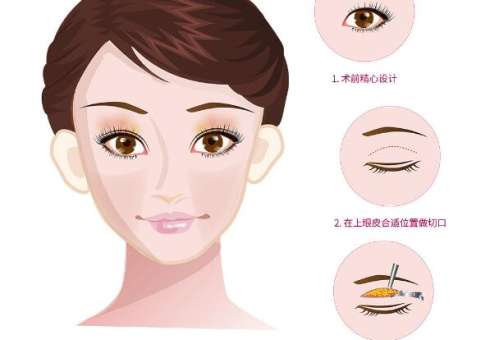 汪树杰医生双眼皮怎么样?医生简介|双眼皮案例分析插图3 汪树杰医生双眼皮怎么样?医生简介|双眼皮案例分析插图3