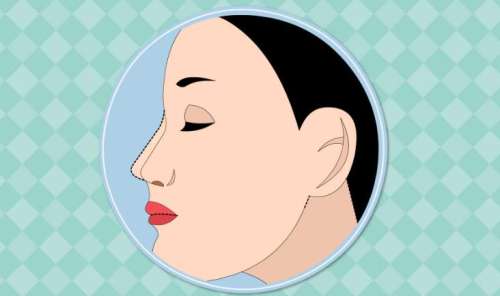 项昌峰做鼻子怎么样?坐诊医院是哪家?隆鼻案例分析插图2 项昌峰做鼻子怎么样?坐诊医院是哪家?隆鼻案例分析插图2