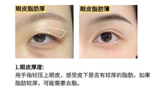 合肥双眼皮曹林咋样?医生坐诊医院介绍插图4 合肥双眼皮曹林咋样?医生坐诊医院介绍插图4