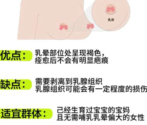 惠州隆胸医生排名推荐!医生口碑评价来袭!就诊必看!插图4 惠州隆胸医生排名推荐!医生口碑评价来袭!就诊必看!插图4