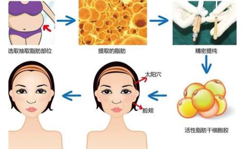 上海九院谢芸技术怎么样?医生简介+手术案例分析插图1