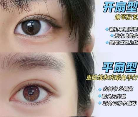 烟台双眼皮好的大夫都有谁?医生排行榜单分析!插图4 烟台双眼皮好的大夫都有谁?医生排行榜单分析!插图4