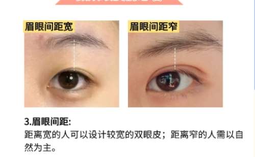 合肥双眼皮修复哪个医生医生做的好?一键查看基本信息!插图4 合肥双眼皮修复哪个医生医生做的好?一键查看基本信息!插图4