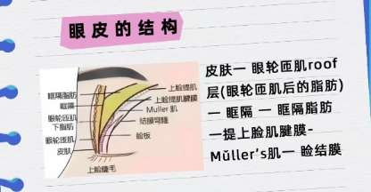 南宁双眼皮修复哪个医生有经验?医生技术精湛精益求精!插图4 南宁双眼皮修复哪个医生有经验?医生技术精湛精益求精!插图4