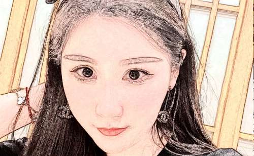 中石油中心医院去眼袋技术评测怎么样?案例分析插图1 中石油中心医院去眼袋技术评测怎么样?案例分析插图1