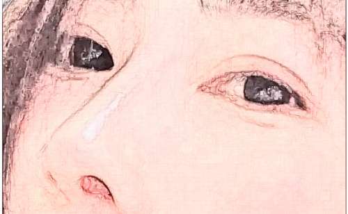 八大处整形医院胡金天隆鼻120天案例曝光(效果怎么样?技术特点)插图2 八大处整形医院胡金天隆鼻120天案例曝光(效果怎么样?技术特点)插图2