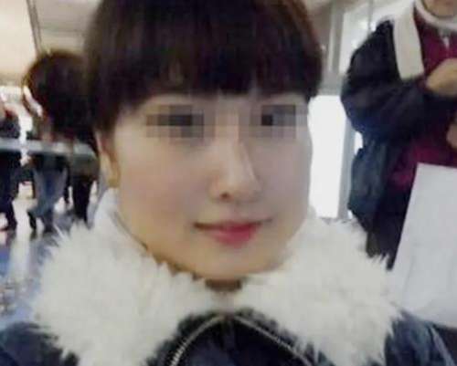 黄大勇颧骨内推案例分析插图1