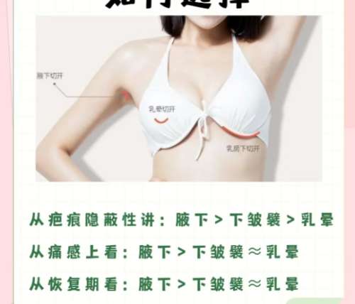 宁波隆胸医生前十名!医生技术实力超群!来看相关介绍插图4 宁波隆胸医生前十名!医生技术实力超群!来看相关介绍插图4