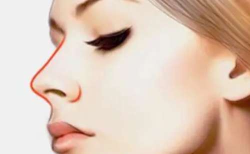 山东省立医院薛峰隆鼻怎么样?最新价格+案例分析+技术优势插图2 山东省立医院薛峰隆鼻怎么样?最新价格+案例分析+技术优势插图2