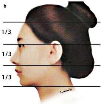 何晋龙磨骨偏什么风格?坐诊医院是哪家?磨骨实例插图2 何晋龙磨骨偏什么风格?坐诊医院是哪家?磨骨实例插图2