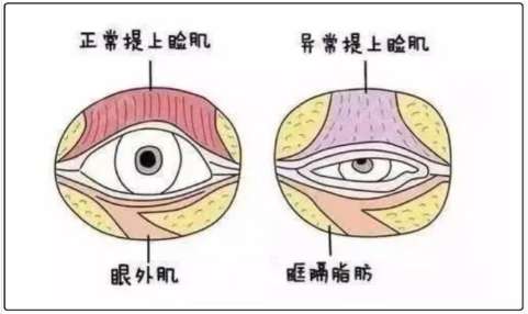金华双眼皮手术做的好的医生有哪些？医生擅长项目详情！插图4