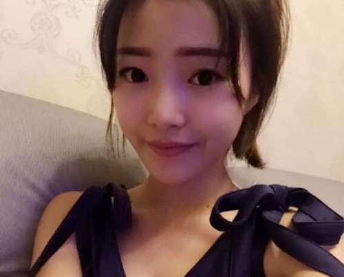 重庆曹阳医生双眼皮修复案例分析插图2