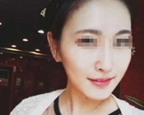 上海华美何斌面吸案例分析插图3 上海华美何斌面吸案例分析插图3