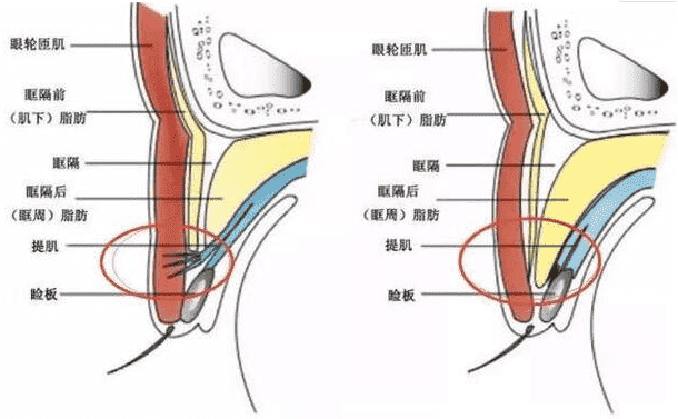 西安医学院第二附属医院双眼皮技术好不好一文带你了解医院实力插图1