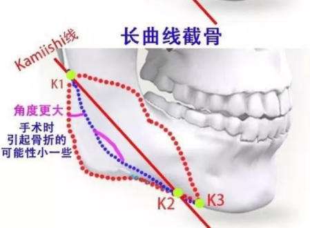 沈绍勇医生的个人简历!医生擅长项目名单揭秘!插图1 沈绍勇医生的个人简历!医生擅长项目名单揭秘!插图1
