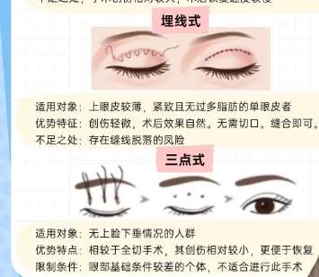 成都双眼皮修复厉害的医生有哪些？医生技术精益求精！插图4