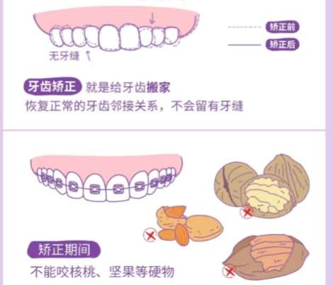 穗华口腔哪个医生好一点?赖仁发、孔卫东、巴娇娇实力在线!插图1 穗华口腔哪个医生好一点?赖仁发、孔卫东、巴娇娇实力在线!插图1