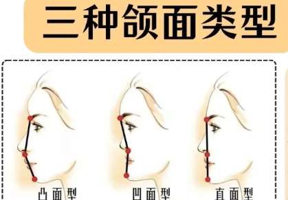 南京颌面外科医生哪个比较好?医生技术精通注重细节!插图4 南京颌面外科医生哪个比较好?医生技术精通注重细节!插图4