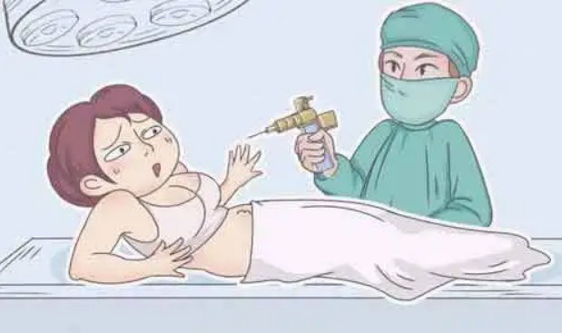 杭州臀部吸脂好吗导致吸脂失败的原因又有哪些呢插图