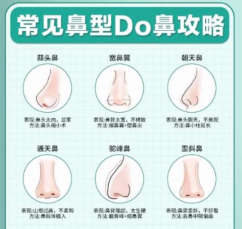 徐威医生的医生简介来袭!客户口碑真实测评!插图1 徐威医生的医生简介来袭!客户口碑真实测评!插图1