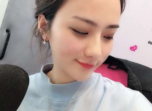 何照华改脸型案例分析插图3 何照华改脸型案例分析插图3