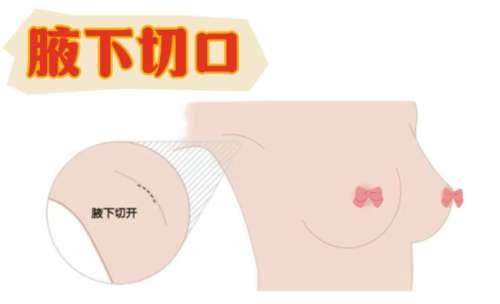 中山隆胸医生前十名！他们擅长的项目以及技术信息介绍插图4