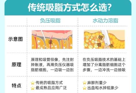 深圳吸脂专家排名前十名单曝光!专家简介!插图4 深圳吸脂专家排名前十名单曝光!专家简介!插图4